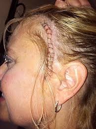 Holly champions new cancer treatment: Long Grove woman promotes the success  of proton therapy