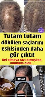 Sac Dolgunlastirma