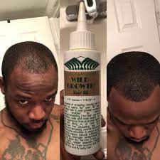 Promotes thick, long hair growth Www