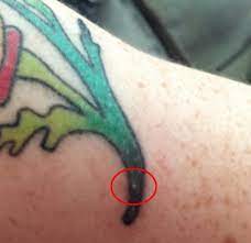 My tattoo has little bumps. White Bumps Spots On New And Old Tattoos Authoritytattoo