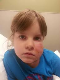 Kitten scratches requiring first aid kit nearby?