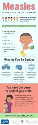 Image result for measles