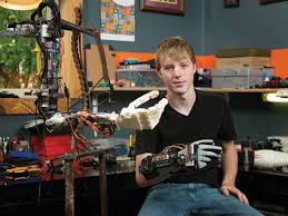 He was struggling to mow the lawn and do the gardening so he needed a hand that could form a fist. 17 Year Old Creates A 3d Printed Robotic Prosthetic Arm For 250