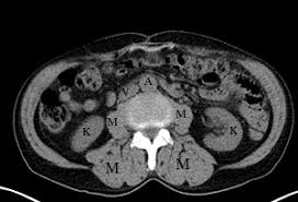 Image result for CT Intravenous Contrast