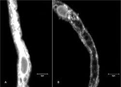 Denn der name verrät es schon, es handelt sich um eine barriere zwischen dem blutkreislaufund dem gehirn, genauer gesagt. Blut Hirn Schranke Wie Arzneistoffe Die Barriere Uberwinden Pz Pharmazeutische Zeitung