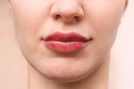 Turning Back The Time… Why Dissolving Your Filler Doesn'T Have To Be A  Negative Experience. — Update Aesthetic