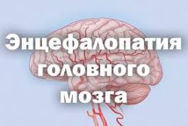 Порой диагнозы, которые ставят близким, пугают родственников. Encefalopatiya Diagnosticheskij Klinicheskij Centr 1 Dkc 1 Facebook