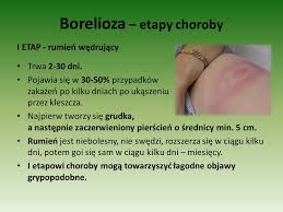 Początkowo w miejscu ukąszenia pojawia się zaczerwieniona grudka, która przechodzi w. Choroby Odkleszczowe Borelioza Kleszczowe Zapalenie Mozgu Ppt Pobierz