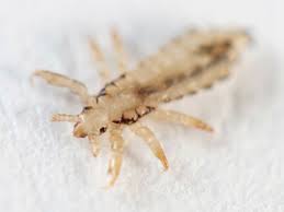 Clinical team members, such as registered nurses (rns), radiologic technicians (rts) and medical assistants, play a critical role at every medexpress center. Head Lice The Horrors And The Cures Wonderbaba