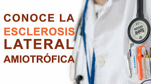 La esclerosis lateral amiotrófica afecta, tanto la primera como la segunda motoneurona que se ocupan de inervar los músculos voluntarios. La Esclerosis Lateral Amiotrofica Ela Conocela Sin Miedo Informacion De Interes Sobre Diversidad Funcional Salud Y Bienestar