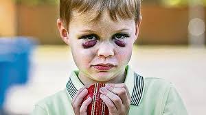 Boy, five, concussed by stray cricket ball