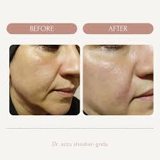 reshape clinic (@drazza.reshape_clinic) • Instagram photos and videos