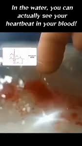 Image result for Collapsing Pulse