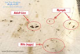 Image result for lice vs nits
