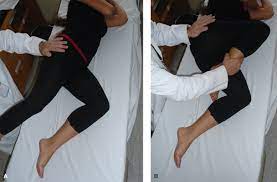Extra Articular Snapping Hip Syndromes Musculoskeletal Key