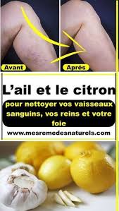 Remede Maison Pour Nettoyer Vos Vaisseaux Sanguins Vos Reins Et Votre Foie Health Health Tips Coconut Health Benefits