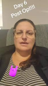 Peeled Lesion Off Rib Muscle Fascia Post Surgery Pain