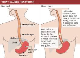 It is low in fat and can be used in cooking, however make sure that you i haven continuously getting bitter taste in mouth and food is remain in throat like feeling i got.please advice suitable treatment. What Is Heartburn Or Gastroesophageal Reflux Ger Apollo Hospitals Blog