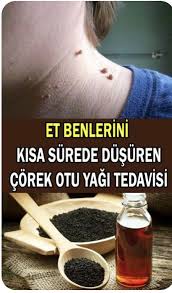 Et Beni Tedavisi Et Beni Bitkisel Tedavisi 2020 Otlar Saglikli Yasam Tarzi Saglik