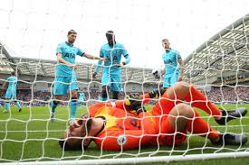 Tottenham hotspur is sweating over hugo lloris' fitness ahead of the north london derby lloris has been in great shape this season and has already saved the lilywhites a few crucial points in the. Dislocated Elbow Will Sideline Hugo Lloris For Foreseeable Future Cartilage Free Captain