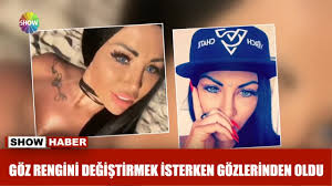 Goz Rengini Degistirmek Isterken Gozlerinden Oldu Youtube