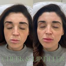 Siân Amy Aesthetics