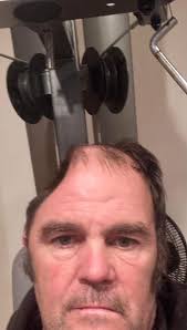 Grateful for life-saving skull replacement surgery