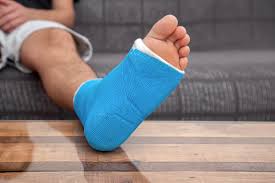 Image result for Foot Fracture