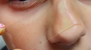 Image result for Diascopy