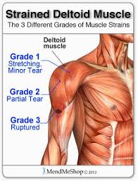 Pin On Shoulder Pain