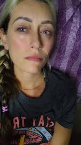 Slayton Green Atv Accident