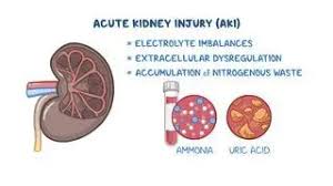 Image result for Postrenal Failure