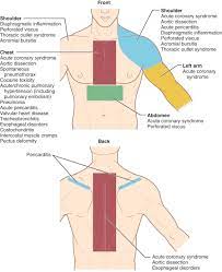 Many people think that it is neurology | anatomy & function of the cerebellum. Chest Pain Thoracic Key