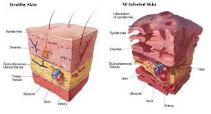 Often dark interiors were counterbalanced by multiple windows and porches to bring in light.|stickley's concepts of home embraced a range of decorative elements as well, including lighting (sconces, chandeliers and table lamps), hardware, rugs, linens and fabrics as well as chairs, bookcases, cabinets, tables and other pieces.|in 1908. Can Fournier S Gangrene Be Cured