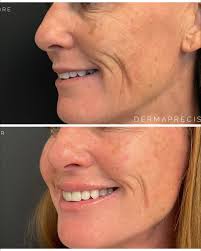 DermaPrecision Aesthetics (@derma.precision) · Scottsdale, AZ