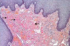Used for amyloid detection h1: Tissue Stained By Means Of A Congo Red Stain Showing A Faint Salmon Download Scientific Diagram