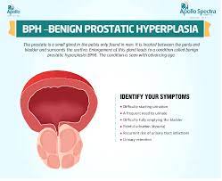 The prostate goes through two main growth periods as a man ages. Enlarged Prostate Treatment And Symptoms Apollo Spectra