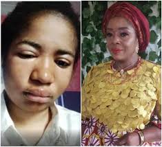 Ada jesus' mother said her family does not need the prophet's money but only needed him to forgive ada jesus who currently has a kidney ailment so as to help ada jesus recover from the ailment. Fjb5hyjlt Jjhm