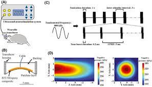 January 2021, january 16, 2021). Low Intensity Pulsed Ultrasound Ameliorates Depression Like Behaviors In A Rat Model Of Chronic Unpredictable Stress Zhang Cns Neuroscience Amp Therapeutics Wiley Online Library