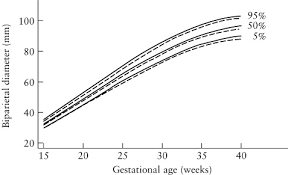 Sex Specific Antenatal Reference Growth Charts For