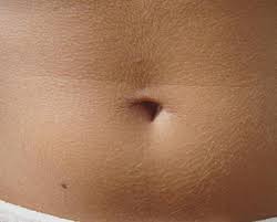 Image result for Umbilicus