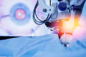 Emerging Technologies for LASIK in 2025 in Los Angeles