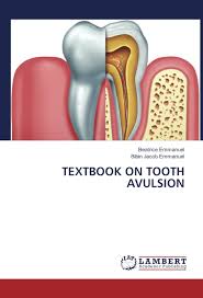 Image result for Tooth Avulsion