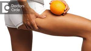 How To Reduce Water Retention In Body? - Ms. Ranjani Raman - Youtube