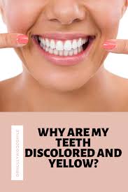 Why Are My Teeth Discolored And Yellow And How To Put A Smile On You Discolored Teeth Good Health Tips Discoloring