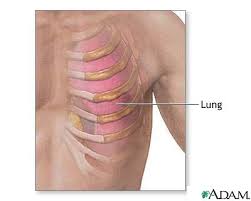 Anatomy of body what under rib age / what body parts are under the rib describe the body of a typical vetrebrae. Ribs And Lung Anatomy Medlineplus Medical Encyclopedia Image