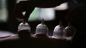 Aug 14, 2016 · cost & cons sessions cost between rs 1,000 and rs 7,000. Michael Phelps Does Cupping Is It Something Worth Paying For Marketwatch