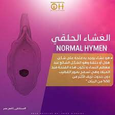 استكمالا موضوع البعبع غشاء البكارة هنتكلم النهاردة عن أنواع غشاء البكارة ولتسهيل ال المعلومة كتبنا أهم المعلومات على كل صورة لتصبح معلومة في صورة أنواع غ oio