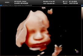 Reviews of Bundle of Joy HD- GTX