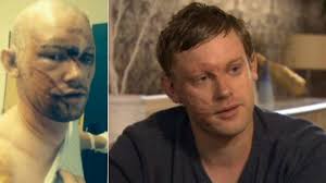 Pair jailed for 'horrific' Thundersley acid attack